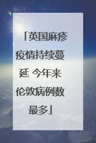 英国麻疹疫情持续蔓延 今年来伦敦病例数最多